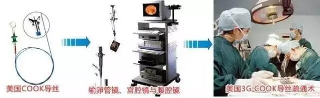 治愈不孕不育的“金钥匙” 宫腹腔镜联合COOK导丝(图2) 治愈不孕不育的“金钥匙” 宫腹腔镜联合COOK导丝(图2)
