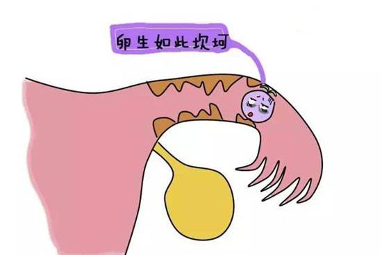 导致输卵管不通畅的原因有哪些(图1)
