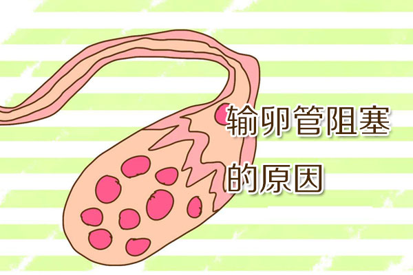 输卵管阻塞的原因(图1)